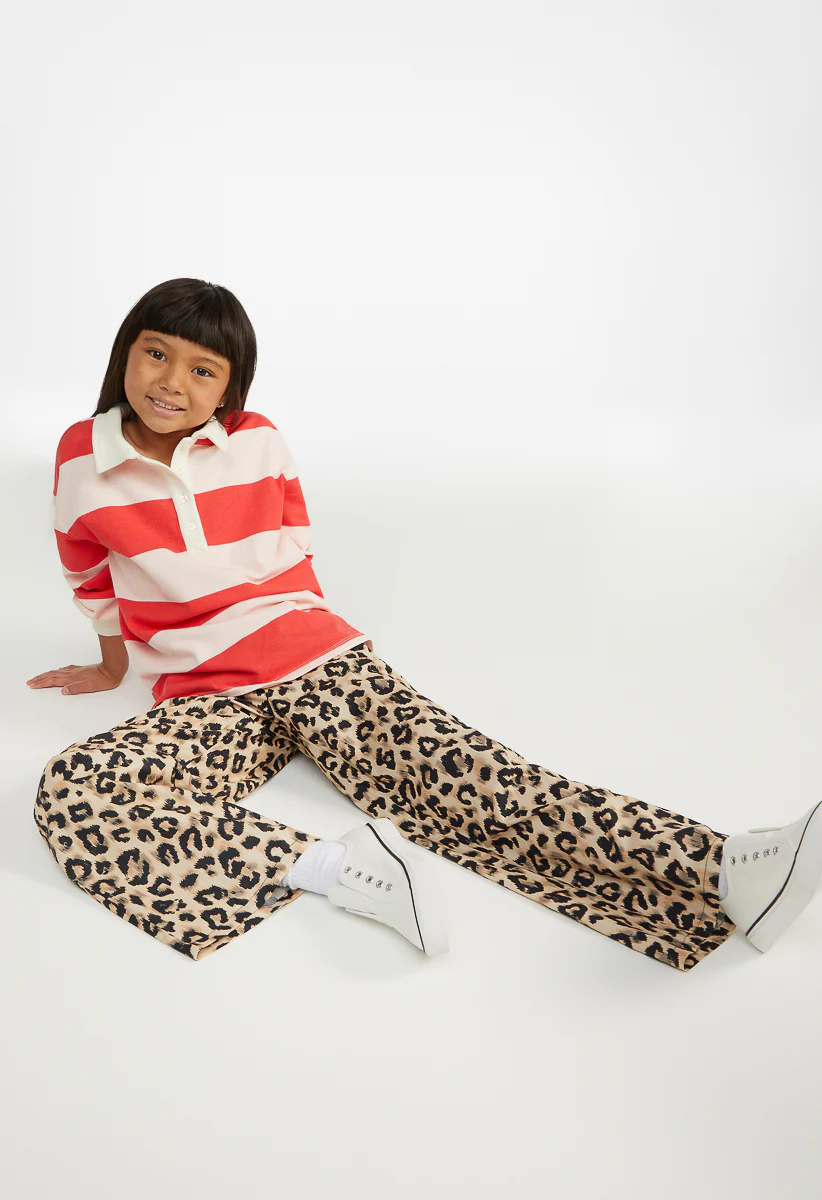 Spotted in Stripes Outfit - Image 3